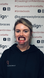 Cheek retractor - for online photo submissions and digital reviews
